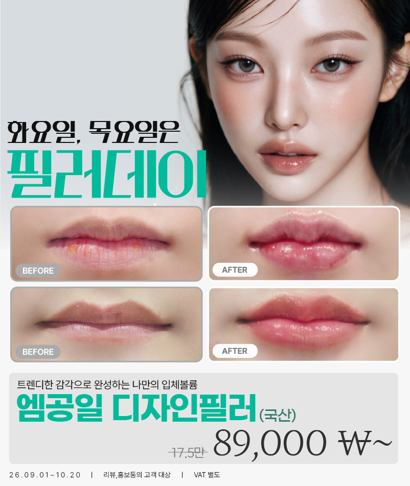 팝업