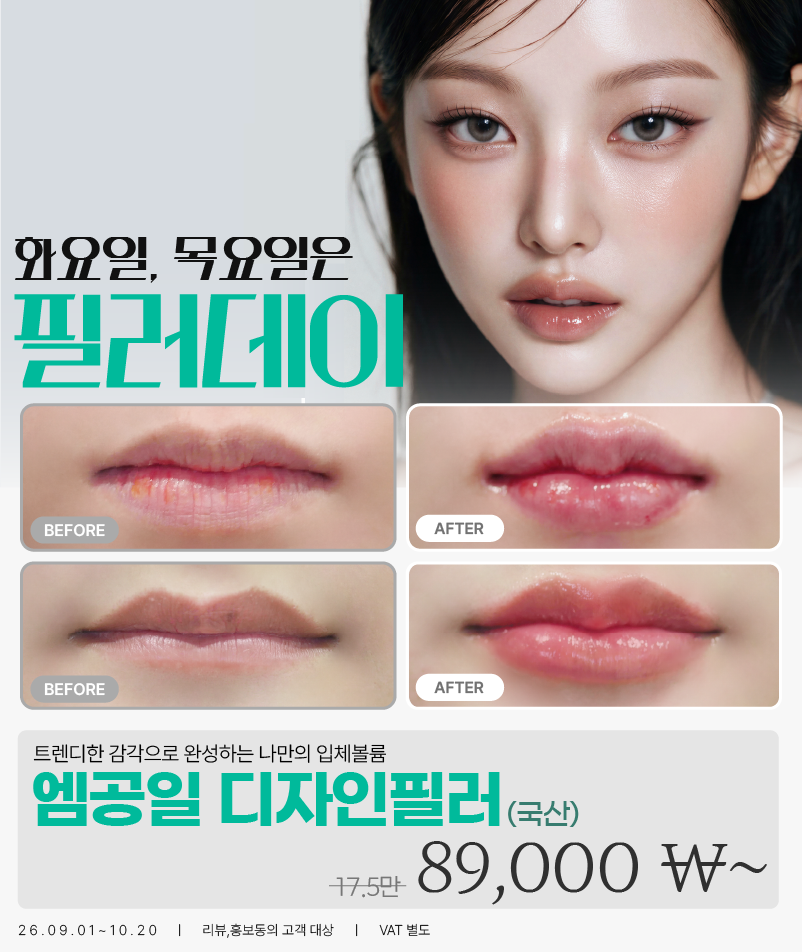팝업