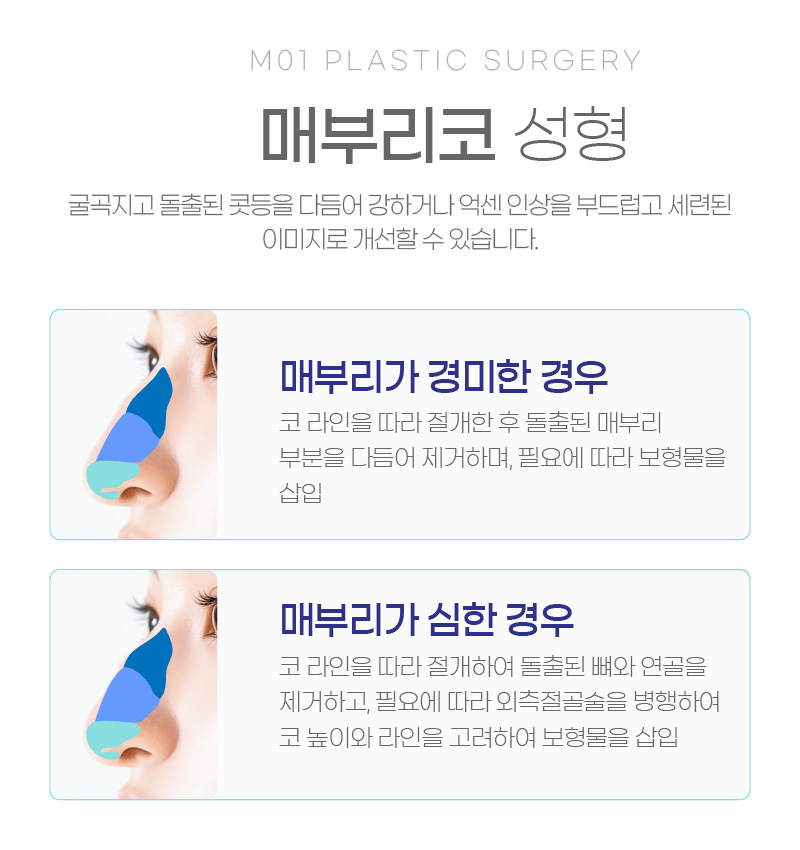 매부리코 성형