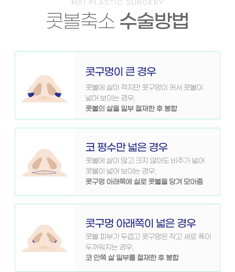 콧볼축소 수술방법