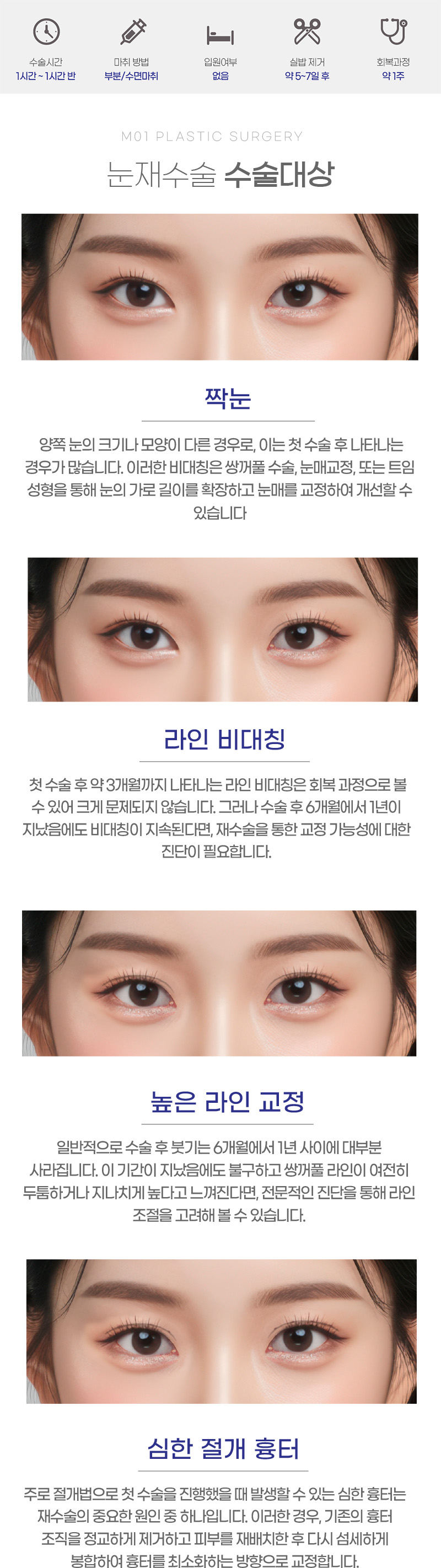 눈재수술 수술대상