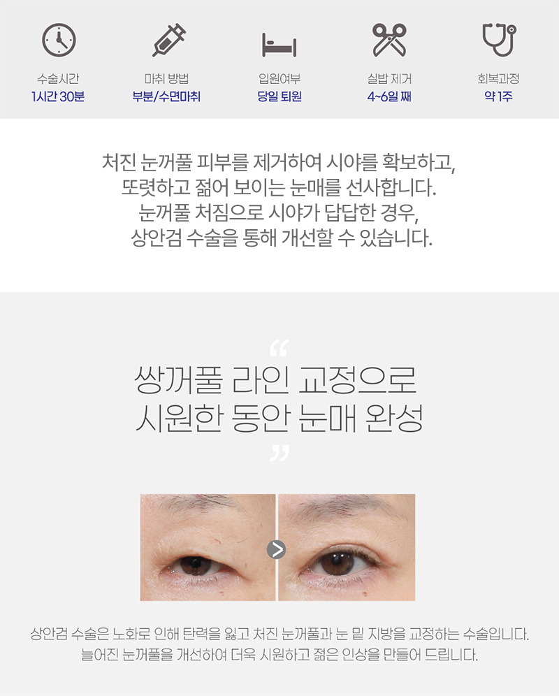 쌍꺼풀 라인 교정으로 시원한 동안 눈매 완성