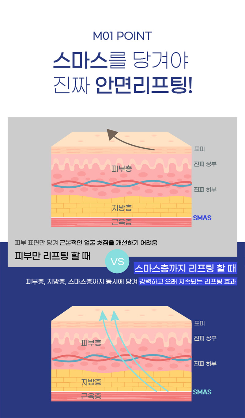 M01 POINT 스마스를 당겨야 진짜 안면리프팅!