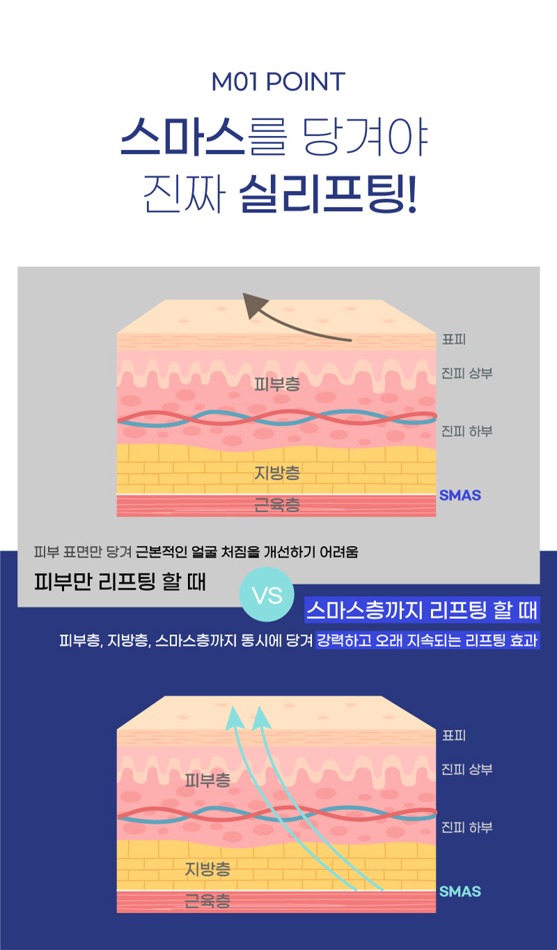 M01 POINT 스마스를 당겨야 진짜 실리프팅!