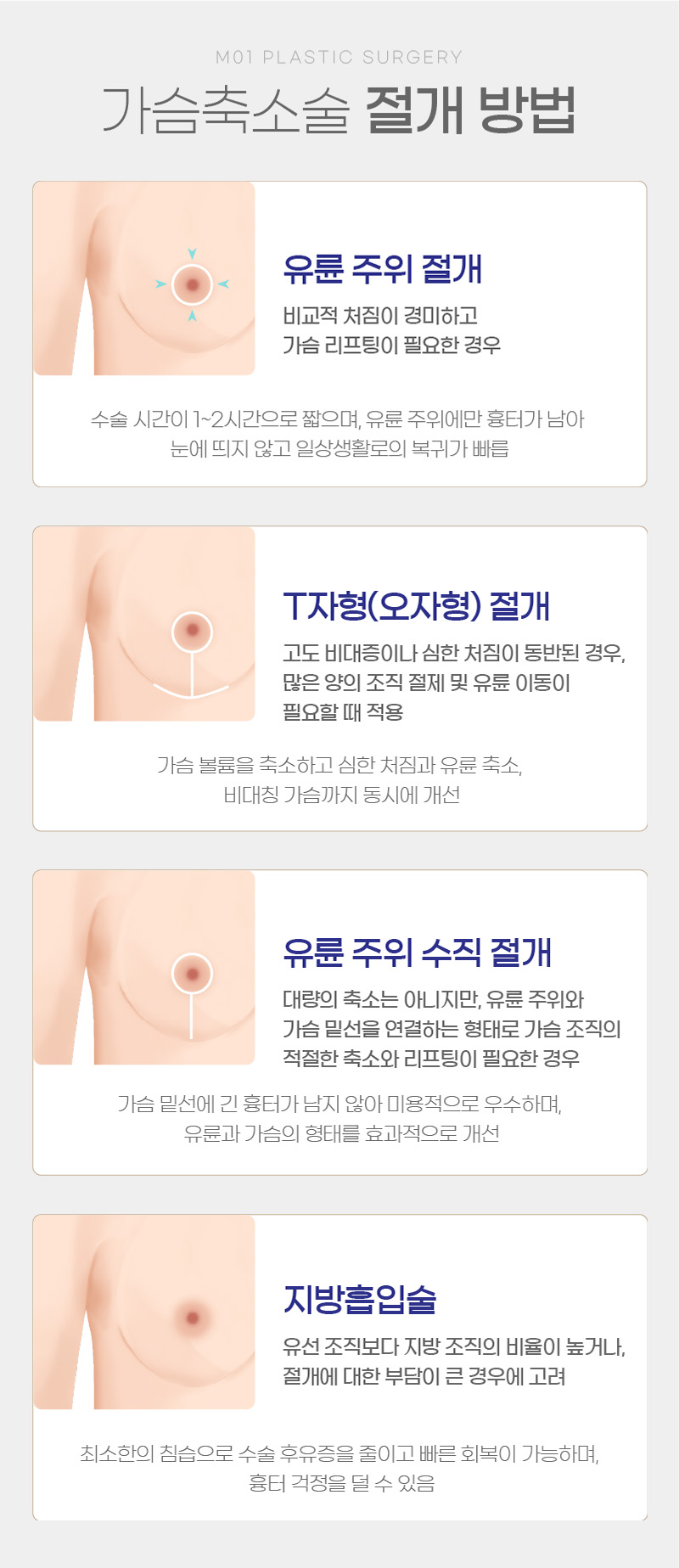 가슴축소술 절개 방법