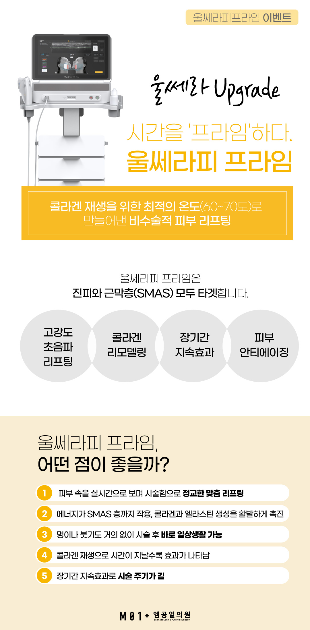 울쎄라 피 프라임 가격/이벤트