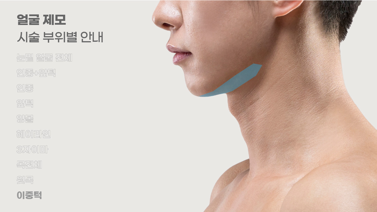 얼굴제모 시술 부위별 안내-10