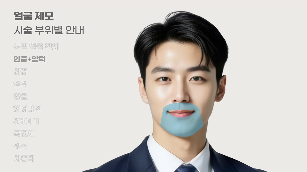 얼굴제모 시술 부위별 안내-2