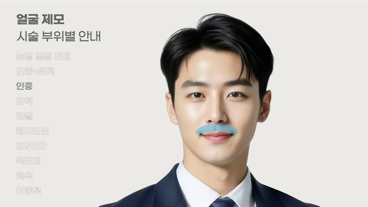 얼굴제모 시술 부위별 안내-3