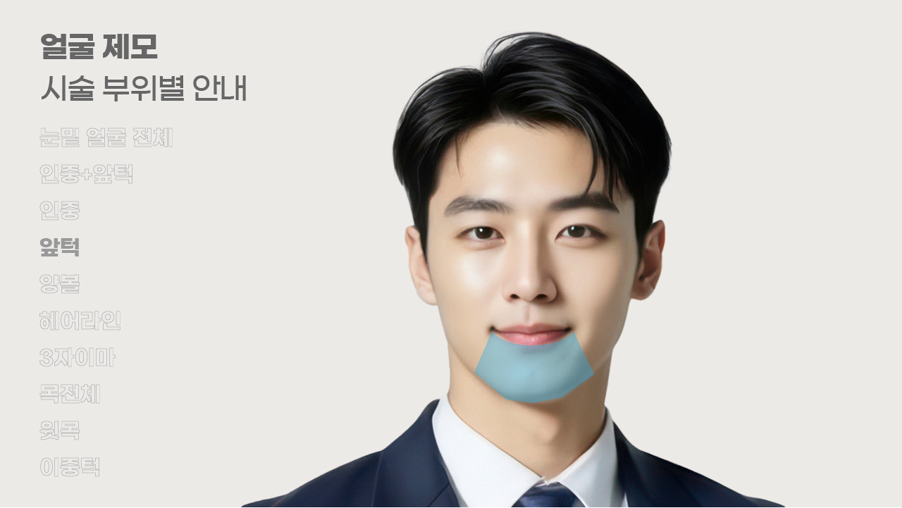 얼굴제모 시술 부위별 안내-4