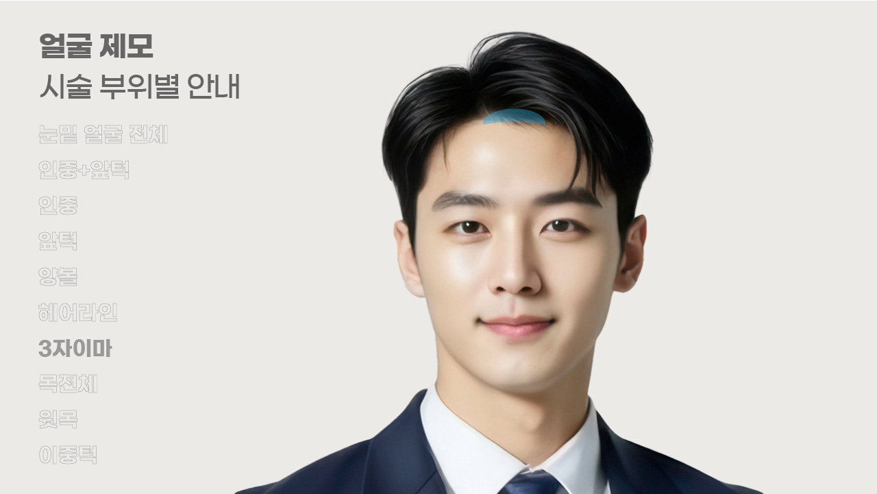 얼굴제모 시술 부위별 안내-7