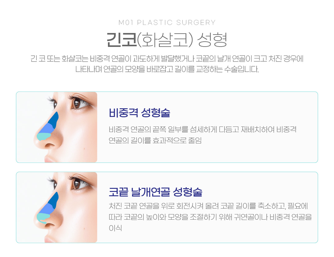 긴코(화살코) 성형