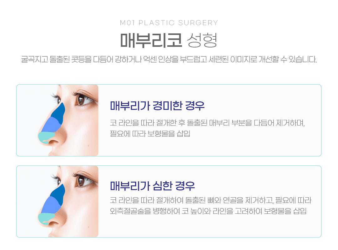 매부리코 성형