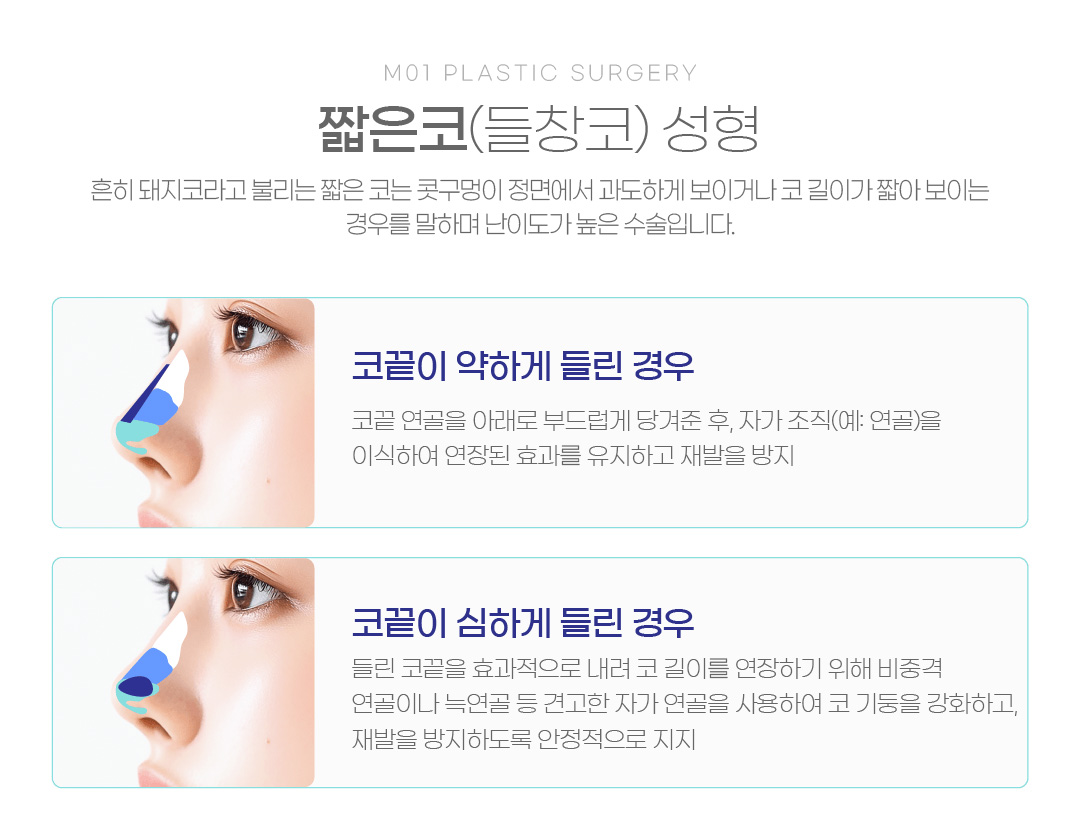 짧은코(들창코) 성형