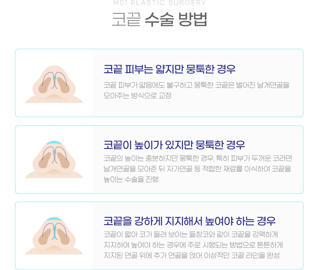 코끝 수술 방법