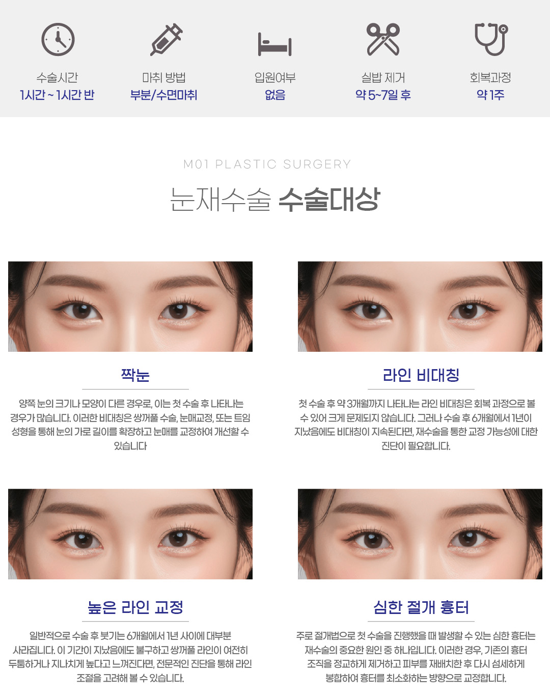 눈재수술 수술대상