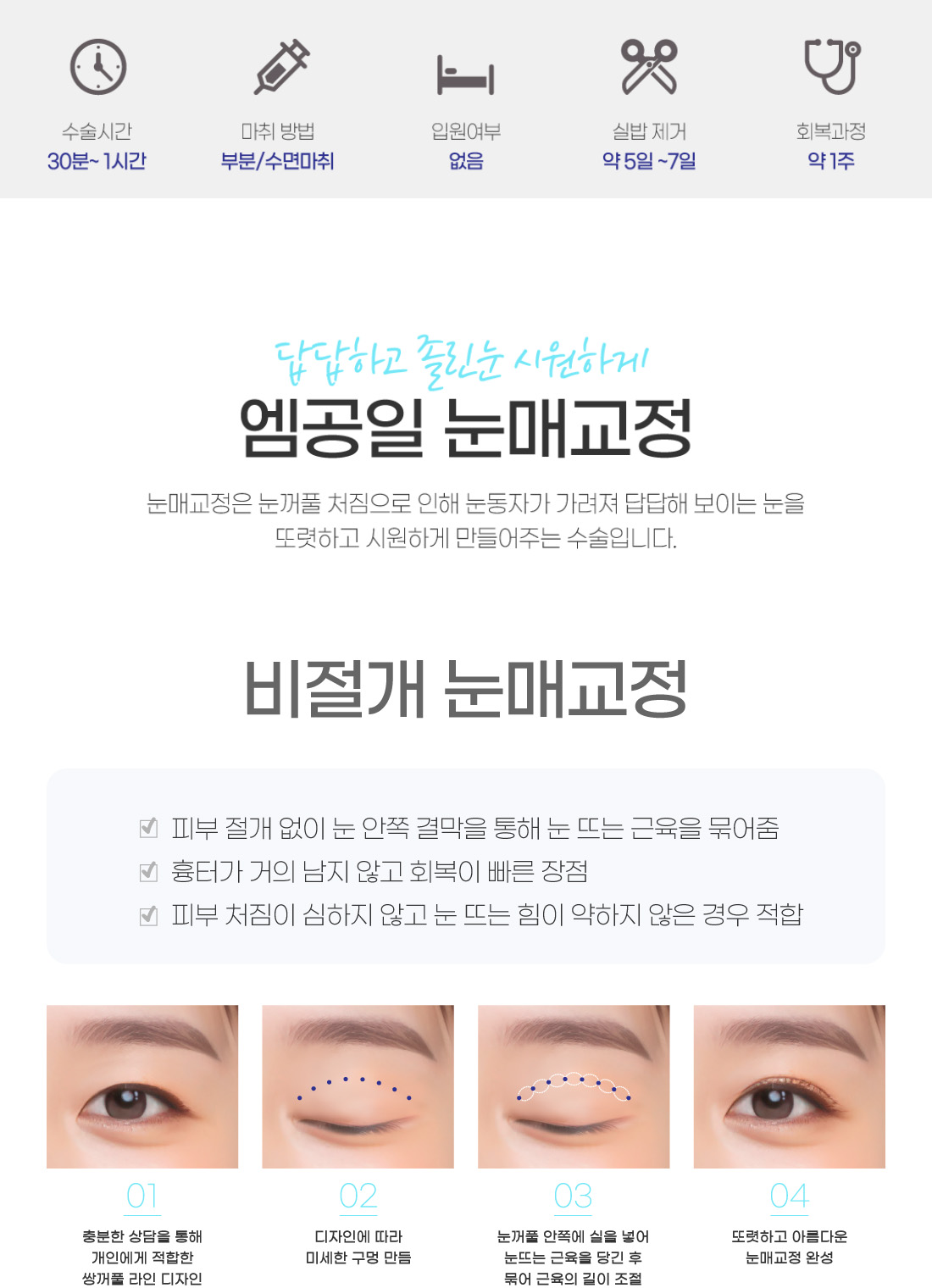 답답하고 졸린눈 시원하게 엠공일 비절개 눈매교정