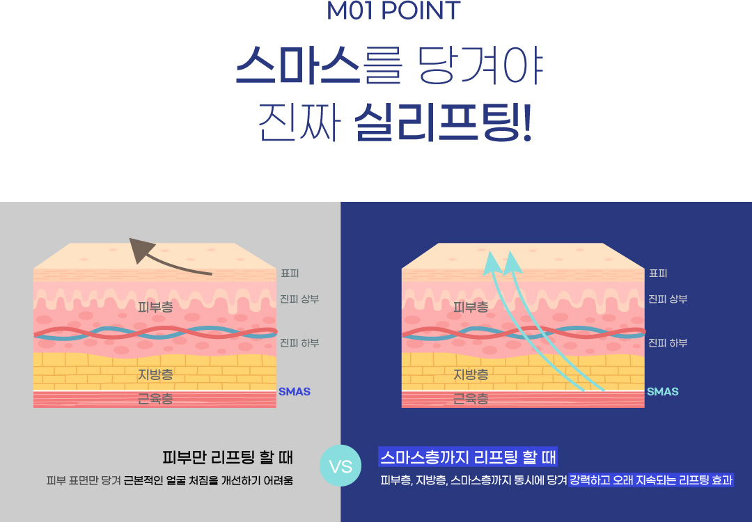 M01 POINT 스마스를 당겨야 진짜 실리프팅!
